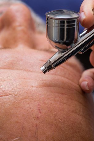 services_oxygen-infusion_